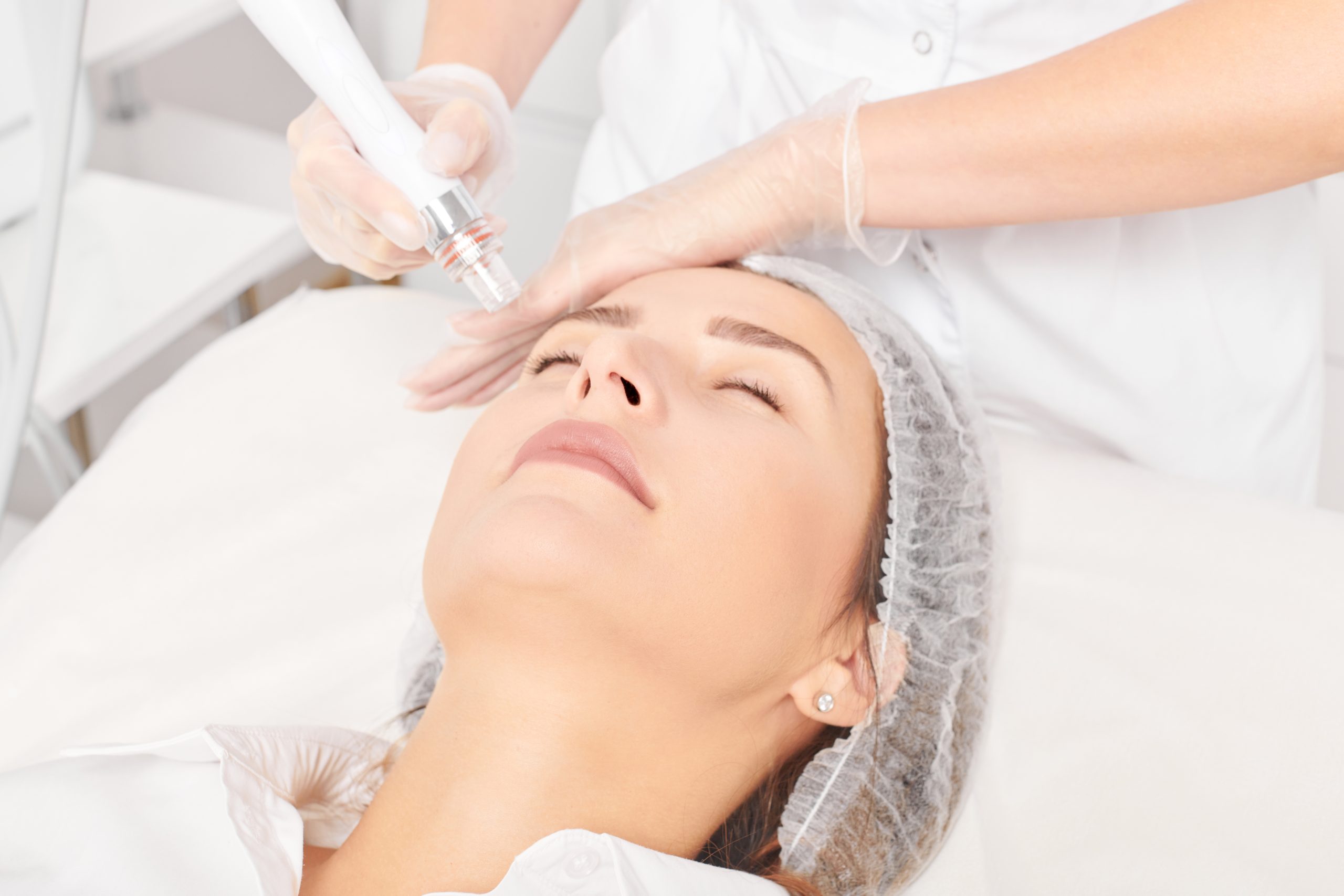 resurfaçage du visage par microdermabrasion